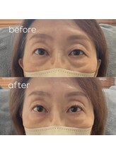 メロー(MELLOW)/まつ毛＋ドライヘッドスパ