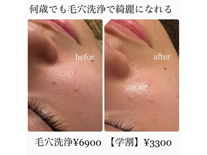 ヌナ(nuna)の写真