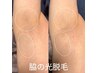【剃刀負け・黒ずみを卒業!/脱毛デビューにも◎】両ワキ 光脱毛 ¥2,000