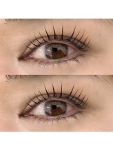 コンジュ ファースト 土橋店(CONJU 1st)/ムーンロッド