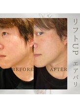 美バリ 新宿店(美BARI)/エアバリ　1回