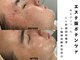 ヴィーナス(Venus)の写真