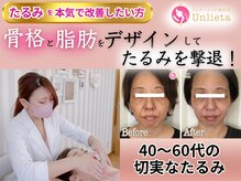 アンリエッタ(Unlieta)