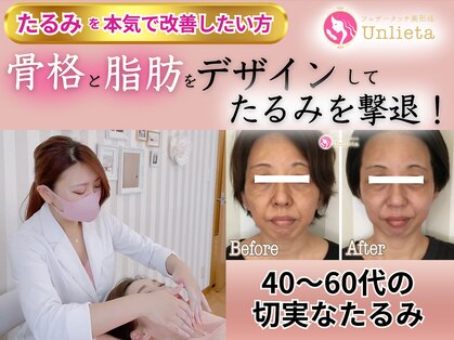 アンリエッタ(Unlieta)の写真