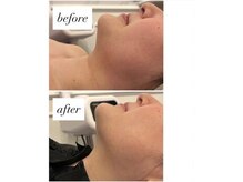 ココセンガビューティークリニック 恵比寿(COCO SENGA Beauty-Clinic)の雰囲気（オンダリフト/インモード/小顔/リフトアップ/毛穴/毛穴洗浄♪♪）