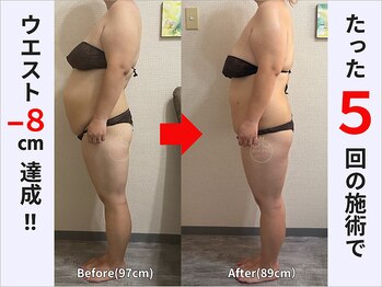 ぷりんす整体コージー(COZY)/【30代 女性】ビフォーアフター