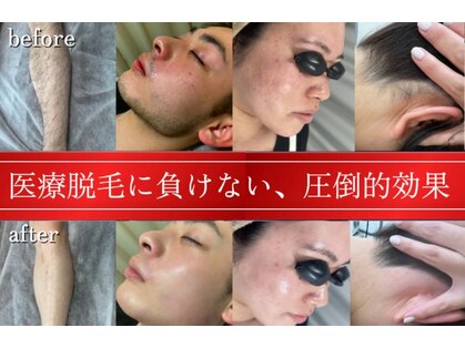 アルゴ 金沢増泉店(ALGO)の写真