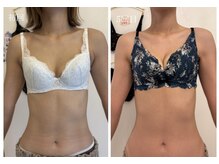 美人バスト 浜松店/◇ バストアップ &nbsp;BeforeAfter◇