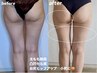 【夏限定★特典付き】感動ヒップアップ×太ももスッキリ体験
