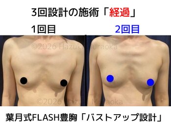 セブンシーズ 上野店(Seven Seas)/バストアップ/豊胸/東京都/上野