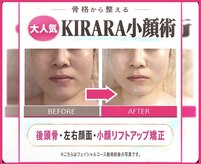 キララ 美容矯正