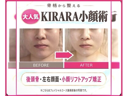 キララ 美容矯正の写真