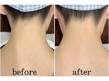 サロン ラズリ(SALON Lazuli)/【ワックス脱毛】うなじ