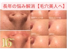 タマンサリ(Taman Sari)の雰囲気（ララピール/プラピールと毛穴ケアが同時に♪ボディもお顔も◎）
