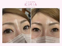 キミア(KIMIA)/バインドロック100束