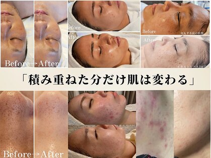 エメ(Aimer)の写真