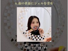 ホワイトニングサロン ホワイト 天童店(WHITE)/6.歯の表面にジェルを塗布