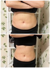 マハロ スコータイ/ビフォーアフター　＜お腹＞