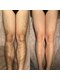メンズ脱毛 ジョルジオ(GIORGIO)の写真/都度払いで気軽に通える♪初めての脱毛でも安心サポート！理想の自分へ導くサロン！