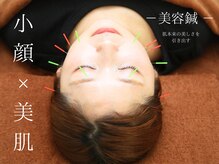 ひまわり整骨院 スポーツ(ひまわり整骨院+SPORTS)