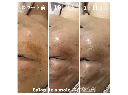 サロンドアモール(Salon de a mole)の写真