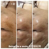 サロンドアモール(Salon de a mole)