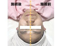 エフ(f)の雰囲気（最強テラボーラー♪施術後すぐにリフトアップと小顔を実感！）