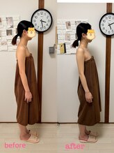 ルアナ(LUANA)/ヘッドスパ、before→after
