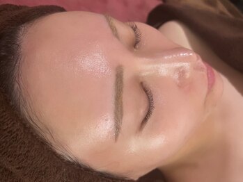 ビハニエルの写真/【当サロンで人気急上昇中！】浸透系最新ピーリングの「プラピール」でお肌の弾力をUPしもっちり美白肌に♪