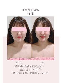 トゥインクル 麻布(twinkle)/南麻布/広尾/白金高輪/小顔矯正