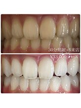 ホワイトニングルーム 横浜店(Whitening Room)/ホワイトニング/横浜