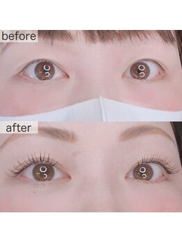 レミーラッシュ 国分寺北口店/LEDフラットラッシュ100本