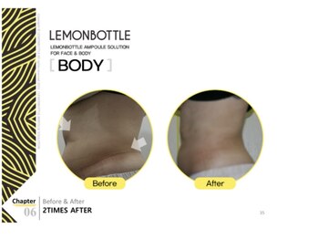 ソラ(sola*)/レモンボトル