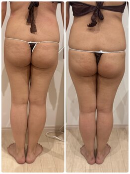 ありひ/セルゼロの効果！！