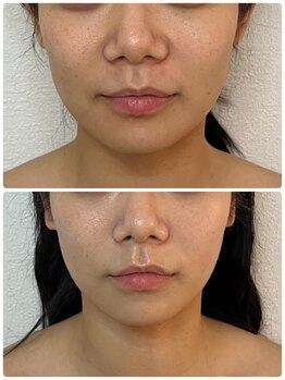 ルミア(LUMIA)/20代／肌トラブルを何とかしたい