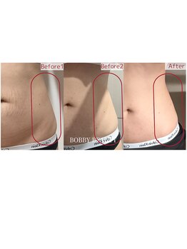 ルルアス(LuLu AS)/