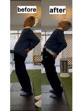 リライズ(re.RAIZE)/70代男性　腰痛