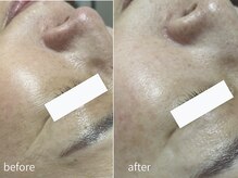 サロン ウル(salon Uru.)/しわ、くすみが抜けトーンアップ