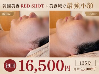 ルポ 那覇(repos)の写真/【韓国美容×最強小顔】最新美容を凝縮☆たるみ・二重顎・ほうれい線に徹底アプローチ！理想の輪郭へ