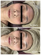 ジャスミン(Jasmin)/臍帯血幹細胞×NMN×AC-11