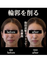クリニカルボーテ 心斎橋院(CLINICAL BEAUTE)/本気の短期集中！結果が別人級！
