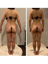 ソウソウビューティー 五反田(Shou Shou Beauty)/ビフォー☆アフター