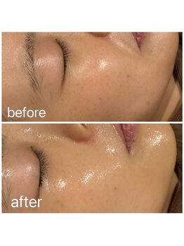 アムールドゥ 麻布十番(Amour deux)/贅沢フルコース4点セット