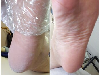 リゼラアンドコー 浦安店/ドイツ式フットケア専門店