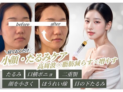 シェリー(Cherie)の写真