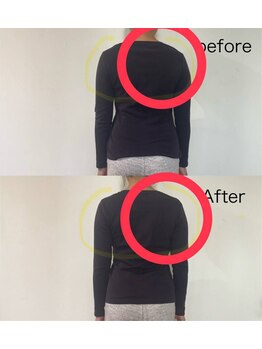 レーヌ(Reine)/肩こり解消、美しい背中をつくる