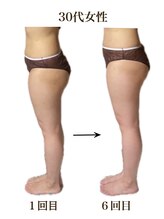 ラニカイ 八代店(Lanikai)/痩身エステ　30代のお客様