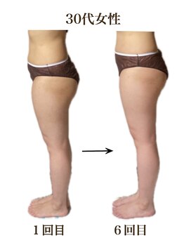 ラニカイ 八代店(Lanikai)/痩身エステ　30代のお客様