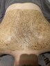 【背中のザラつき・ニキビでお困りの方へ】☆ハーブピーリング（背中）　