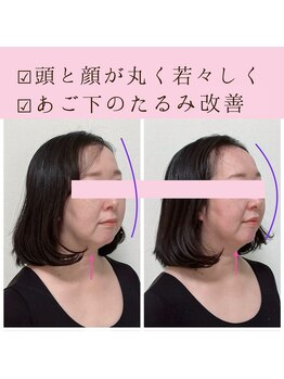 ビーホリック(Bholic)/頭と顔の伸びが短く丸く戻る